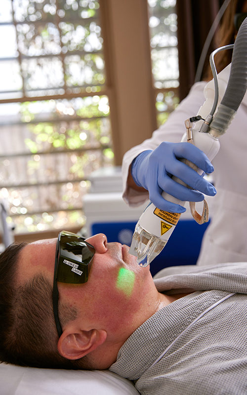 Laser hair removal commonly treated areas: face