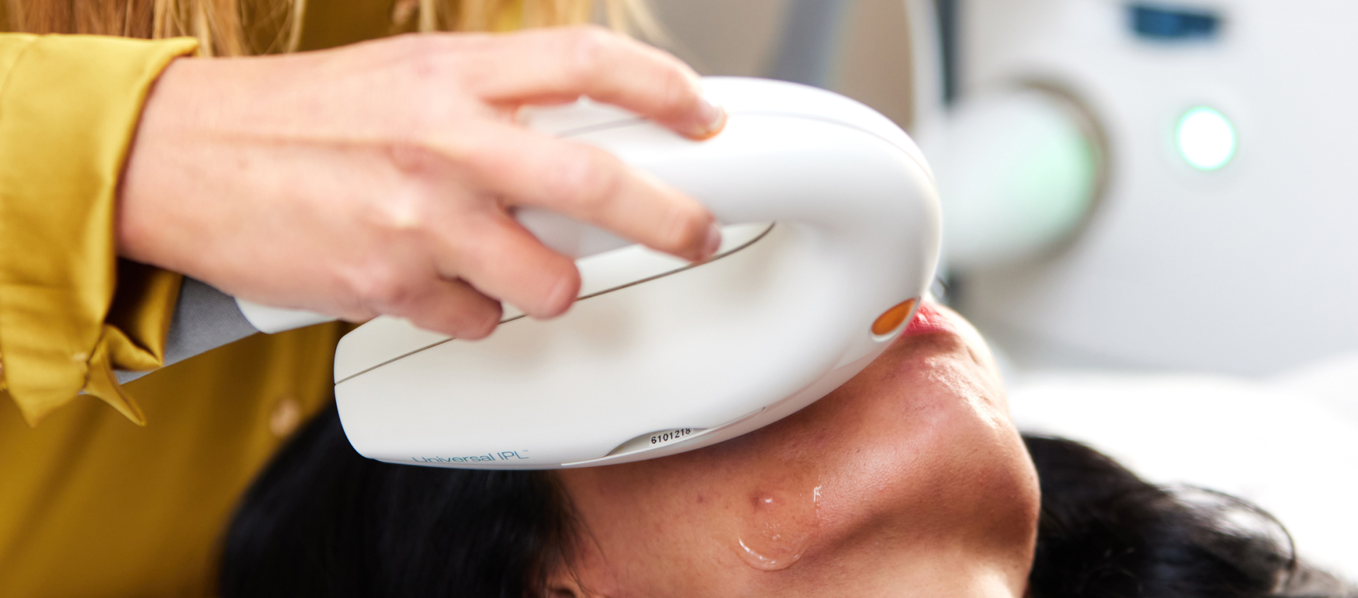 Woman during IPL photorejuvenation solutions for acne session at Alira Med Spa