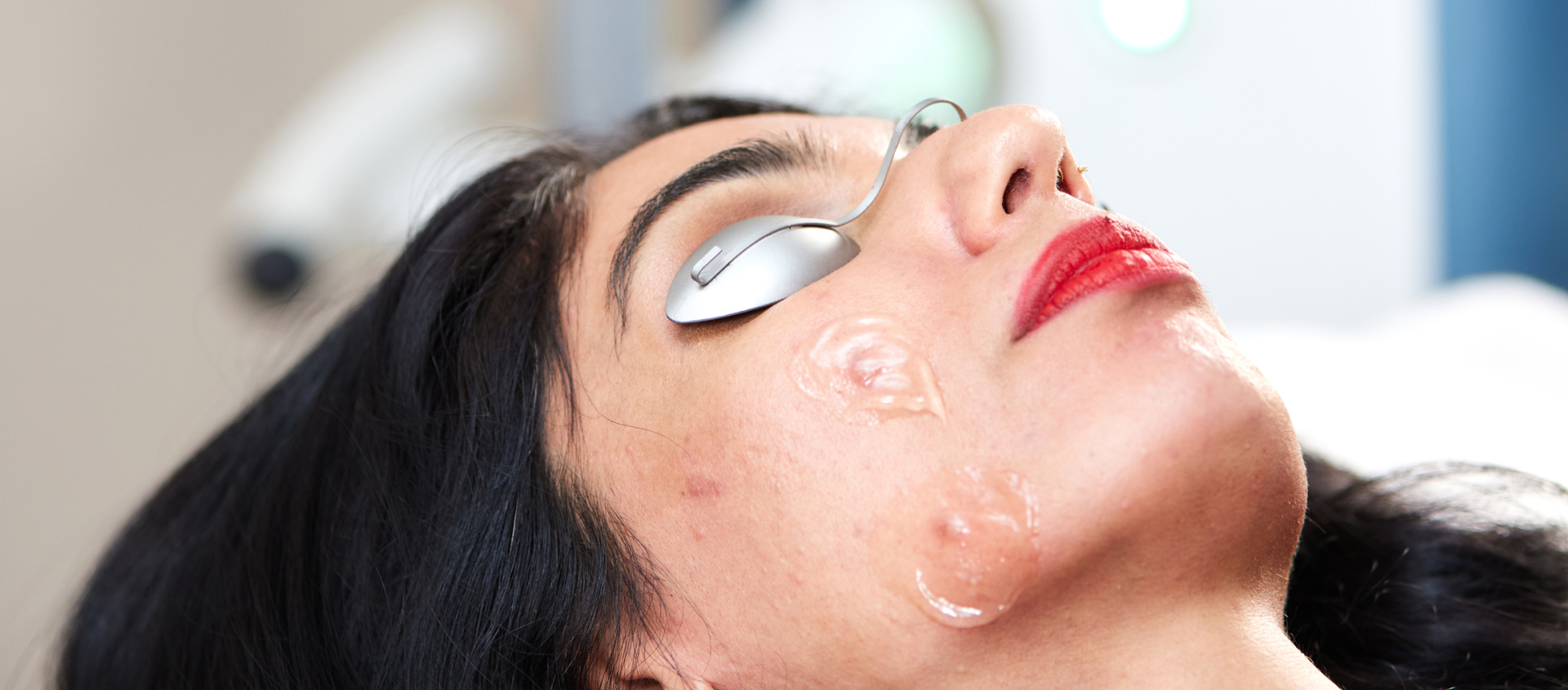 Woman getting ready for an IPL photorejuvenation solutions for acne session at Alira Med Spa